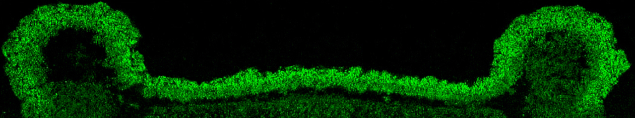 3D yeast colony genomics